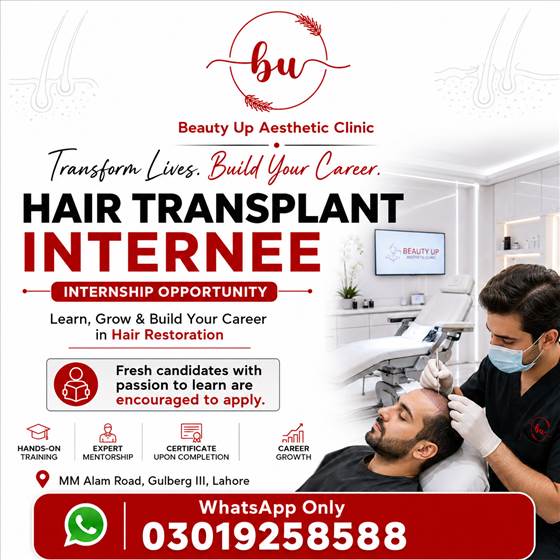 Beauty Up Hair Transplant Internee Ad