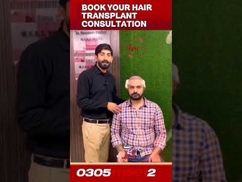 Hair Transplant Consultation in Lahore | Hairline & Hair Loss Assessment