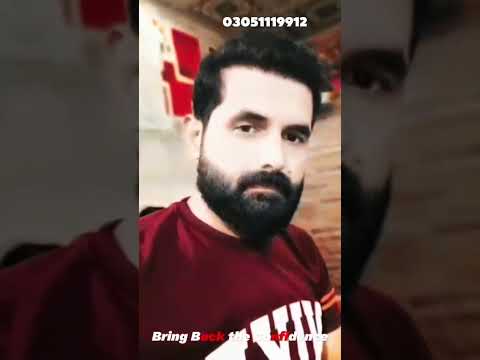 Hair Transplant Before & After Results | Beauty Up Aesthetics Lahore